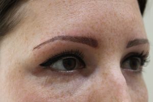 eyebrow-treatments-after